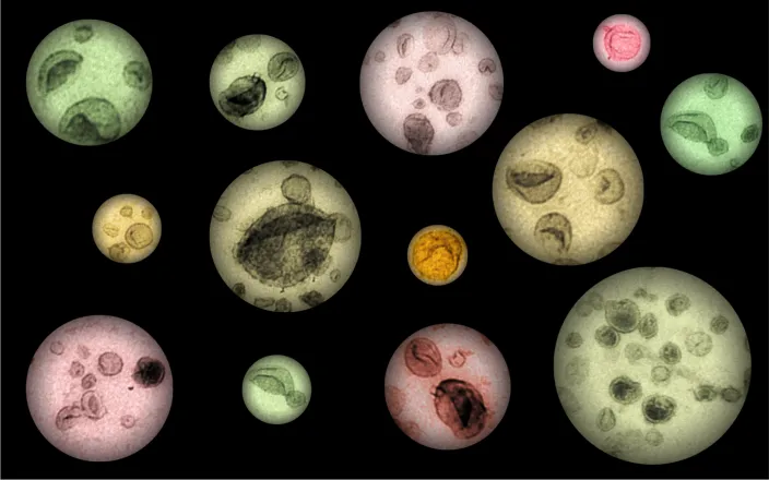 cavitation courses helsinki Institute for Molecular Medicine Finland